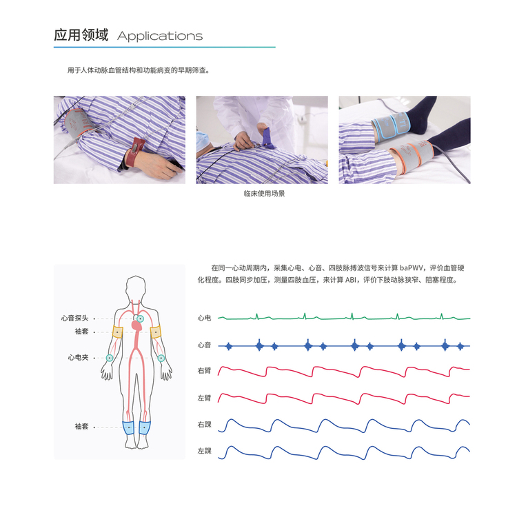 動(dòng)脈硬化檢測儀KAS6800